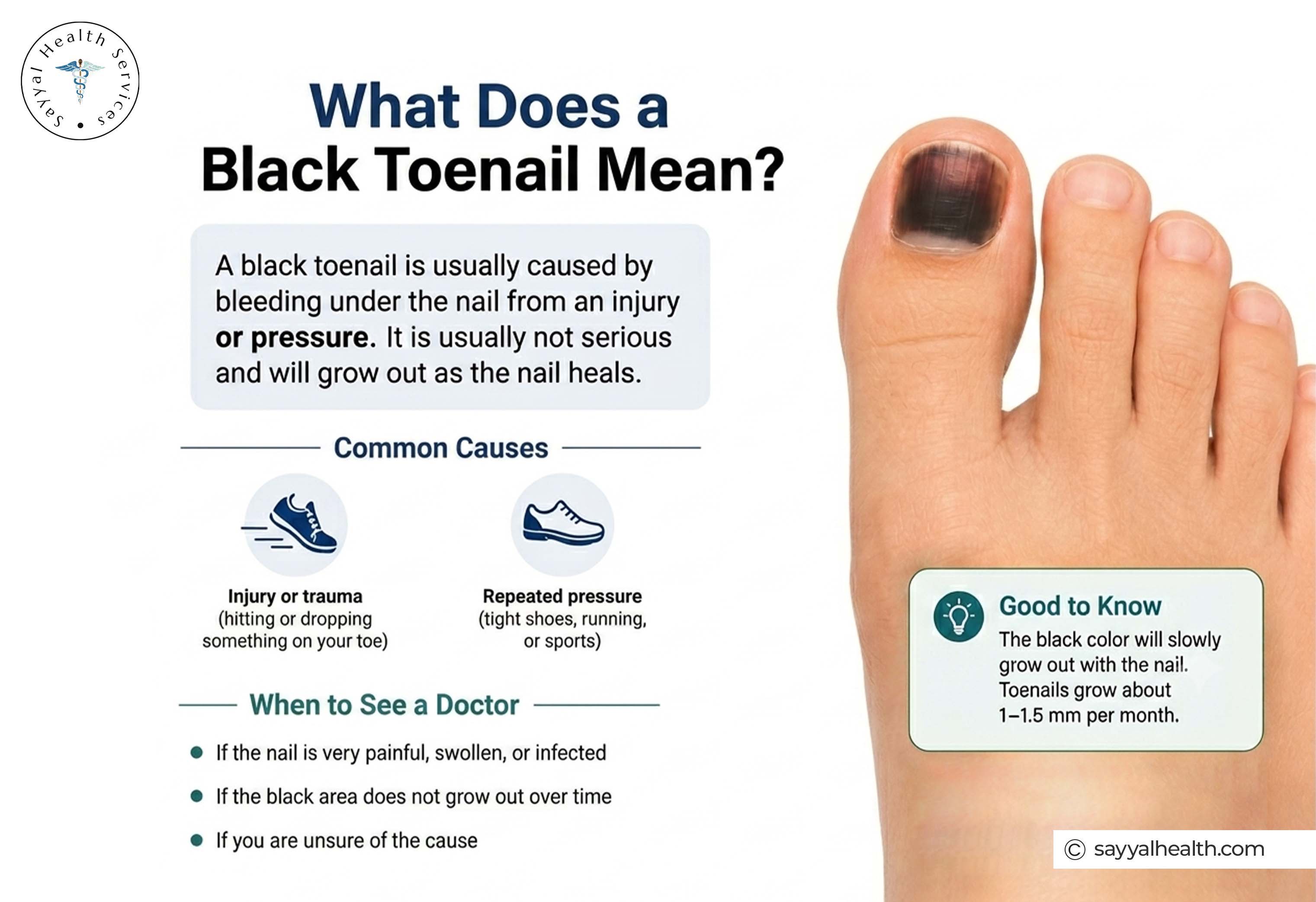 what does a black toenail mean?